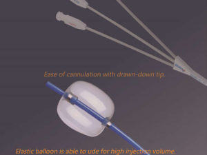 Single-use Stone Retrieval Balloon Catheter